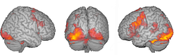 fmri measuring brain response